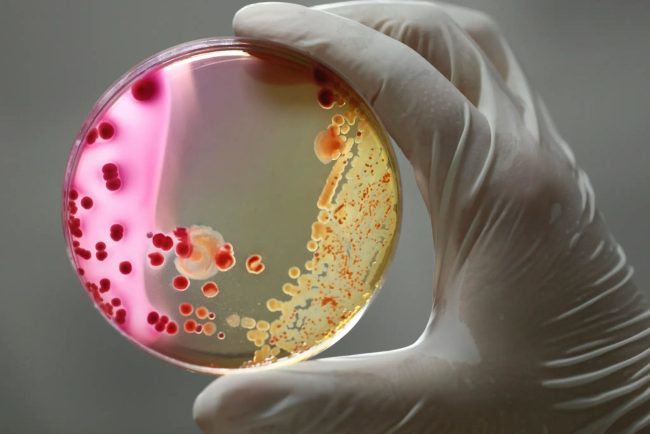 Serratia marcescens bacterie rezistenta la antibiotice in ATI