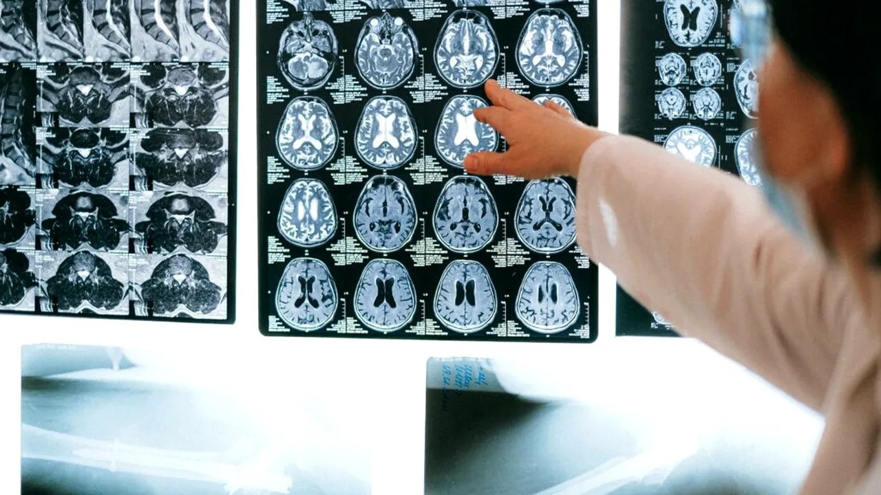 Descoperire in neurostiinte un cercetator german dezvaluie modul in care functioneaza sistemul de navigatie al creierului uman