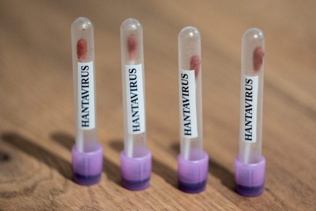 Italia a anuntat ca patru persoane aflate in carantina din cauza hantavirusului au obtinut rezultate negative la teste