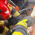 O tanara a fost internata la spital dupa o clipa de neagra in bucatarie Iata ce ar trebui sa eviti cand gatesti
